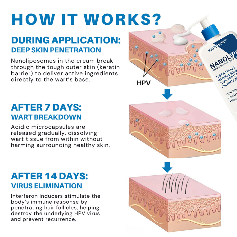 Natravor™ NanoLipo HPV Genital Warts Eraser Cream
