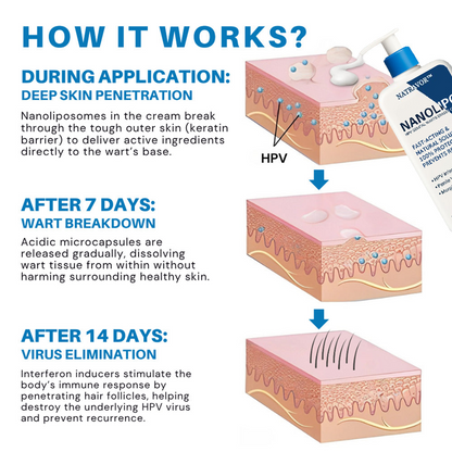 Natravor™ NanoLipo HPV Genital Warts Eraser Cream