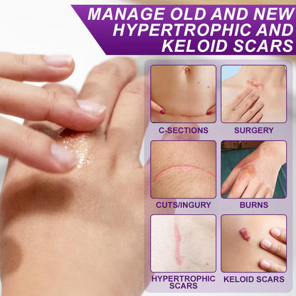 💙 TGA-Certified ✅Misspone® Scar Gel – Clinically Proven to Fade Surgical, Acne, Burn & Trauma Scars