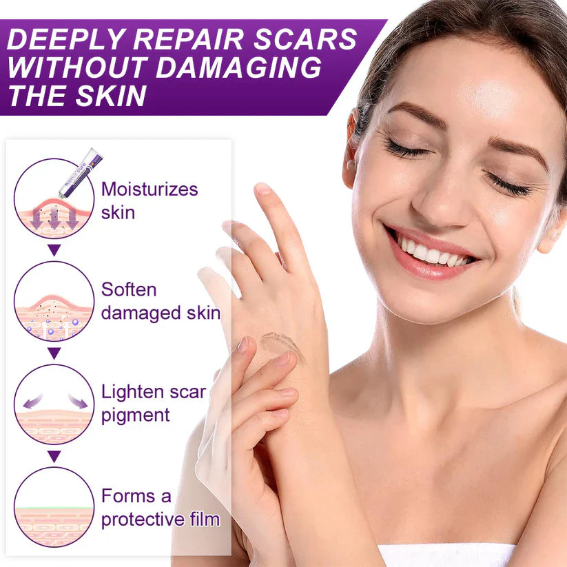 💙 TGA-Certified ✅Misspone® Scar Gel – Clinically Proven to Fade Surgical, Acne, Burn & Trauma Scars