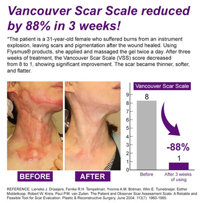 💙 TGA-Certified ✅Misspone® Scar Gel – Clinically Proven to Fade Surgical, Acne, Burn & Trauma Scars