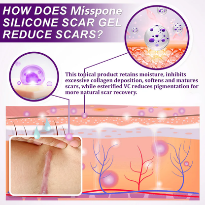 💙 TGA-Certified ✅Misspone® Scar Gel – Clinically Proven to Fade Surgical, Acne, Burn & Trauma Scars
